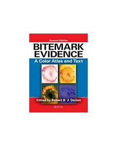 Bitemark Evidence (Instant Digital Access Code Only) 9781439818626