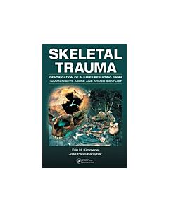 Skeletal Trauma (Instant Digital Access Code Only) 9780849392696