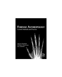 Forensic Anthropology: Current Methods and Practice (Instant Digital Access Code Only) 9780124186712